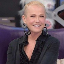 Xuxa passa por transplante capilar e revela detalhes do procedimento - Tupi - Pablo Oliveira