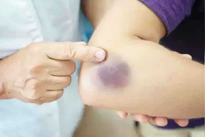 Os riscos da acupuntura são baixos quando feita por profissionais qualificados, mas podem incluir dor leve no local da aplicação, pequenos hematomas, infecção (se não houver higiene adequada) e, em casos raros, perfuração de órgãos se as agulhas forem inseridas incorretamente. Contraindicações incluem distúrbios de coagulação e infecções cutâneas.