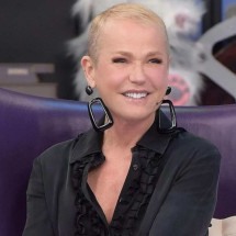 Xuxa passa por transplante capilar e revela detalhes do procedimento - Tupi - Pablo Oliveira