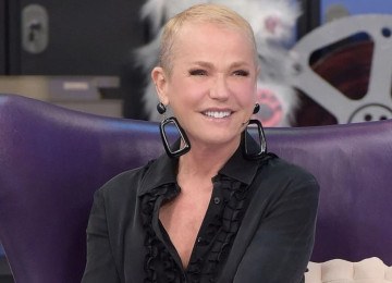 Xuxa passa por transplante capilar e revela detalhes do procedimento - (crédito: Tupi - Pablo Oliveira) Xuxa passa por transplante capilar e revela detalhes do procedimento - (crédito: Tupi - Pablo Oliveira)