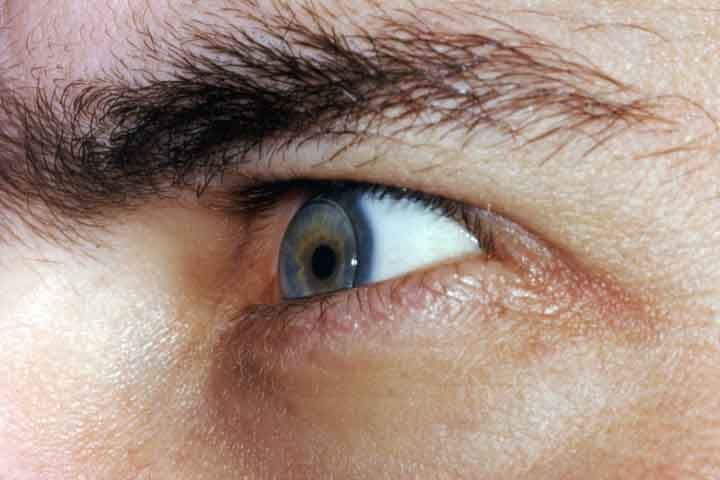 Com a evolução dos materiais e das técnicas de fabricação, as lentes de contato continuam a oferecer novas possibilidades para usuários com diferentes necessidades visuais. No entanto, seu uso requer cuidados específicos para evitar problemas oculares e garantir uma experiência segura e confortável.