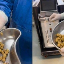 Médico retira 35 pedras de paciente que bebia 3l de refrigerante por dia - Reprodução/Redes sociais