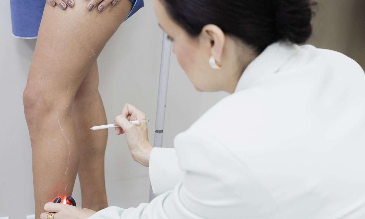 Cinco sinais que podem indicar problemas na circulação - (crédito: DINO)