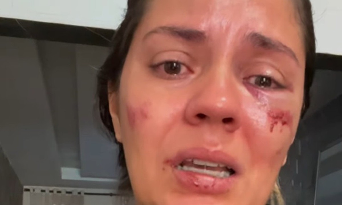 Jaqueline Nascimento disse ter sido arremessada de um tobog&atilde; no feriado de 1&ordm; de Maio -  (crédito: Reprodu&ccedil;&atilde;o/Redes sociais)