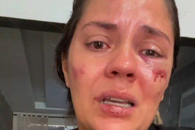 Jaqueline Nascimento disse ter sido arremessada de um tobogã no feriado de 1º de Maio -  (crédito: Reprodução/Redes sociais)