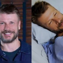 Rodrigo Hilbert passa por cirurgia após acidente na África - Montagem/Reprodução Instagram/TV Globo
