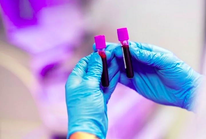 Essa condição acontece quando o tipo sanguíneo da mãe é incompatível com o do bebê.