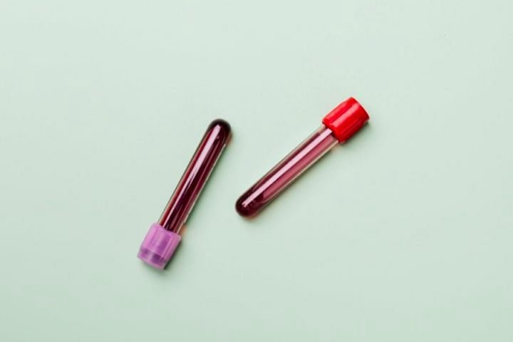 Na Austrália, ele era conhecido como "o homem do braço de ouro" devido à presença de um anticorpo raro em seu sangue, o Anti-D. 