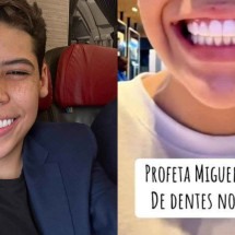 Pastor mirim coloca facetas dentárias aos 14 anos: veja riscos - Instagram/ Tik Tok/ Reprodução