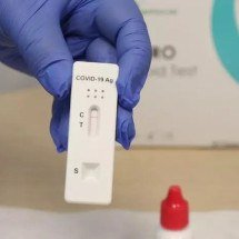 UFMG desenvolve novo teste diagnóstico para Covid-19; entenda - Fábio Marchetto/SES-MG