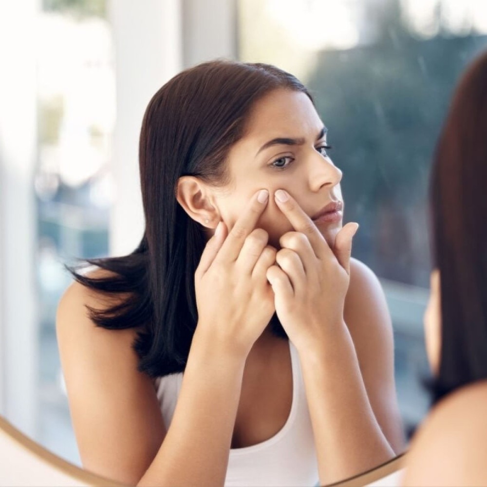 Hidradenite supurativa: a doença que pode ser confundida com acne