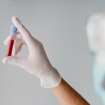 Tuberculose: quem tem doença inflamatória imunomediada deve fazer teste? - FreePik