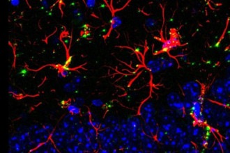 Molécula reverte déficit cognitivo associado ao envelhecimento e à demência