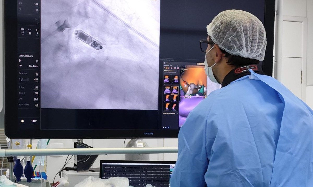 Equipe médica realiza, pela primeira vez em BH, implante do menor marca-passo do mundo em paciente com alto risco de infecção
 -  (crédito: Hospital Madre Teresa/Divulgação)