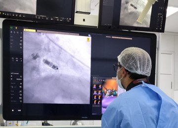 Equipe médica realiza, pela primeira vez em BH, implante do menor marca-passo do mundo em paciente com alto risco de infecção
 -  (crédito: Hospital Madre Teresa/Divulgação)