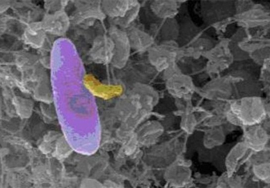 Reprodução da The University of Medicine and Dentistry of New Jersey