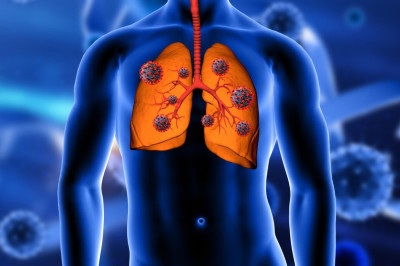 O principal objetivo desse tipo de fisioterapia é a promoção da melhora da função pulmonar -  (crédito: kjpargeter/FreePik)