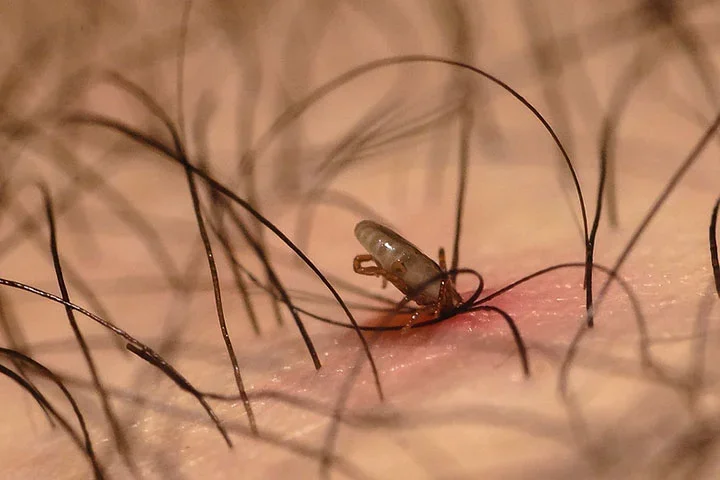 Um programa de banhos regulares com produtos para carrapatos deve ser seguido para eliminar os insetos e evitar novas infestações. 