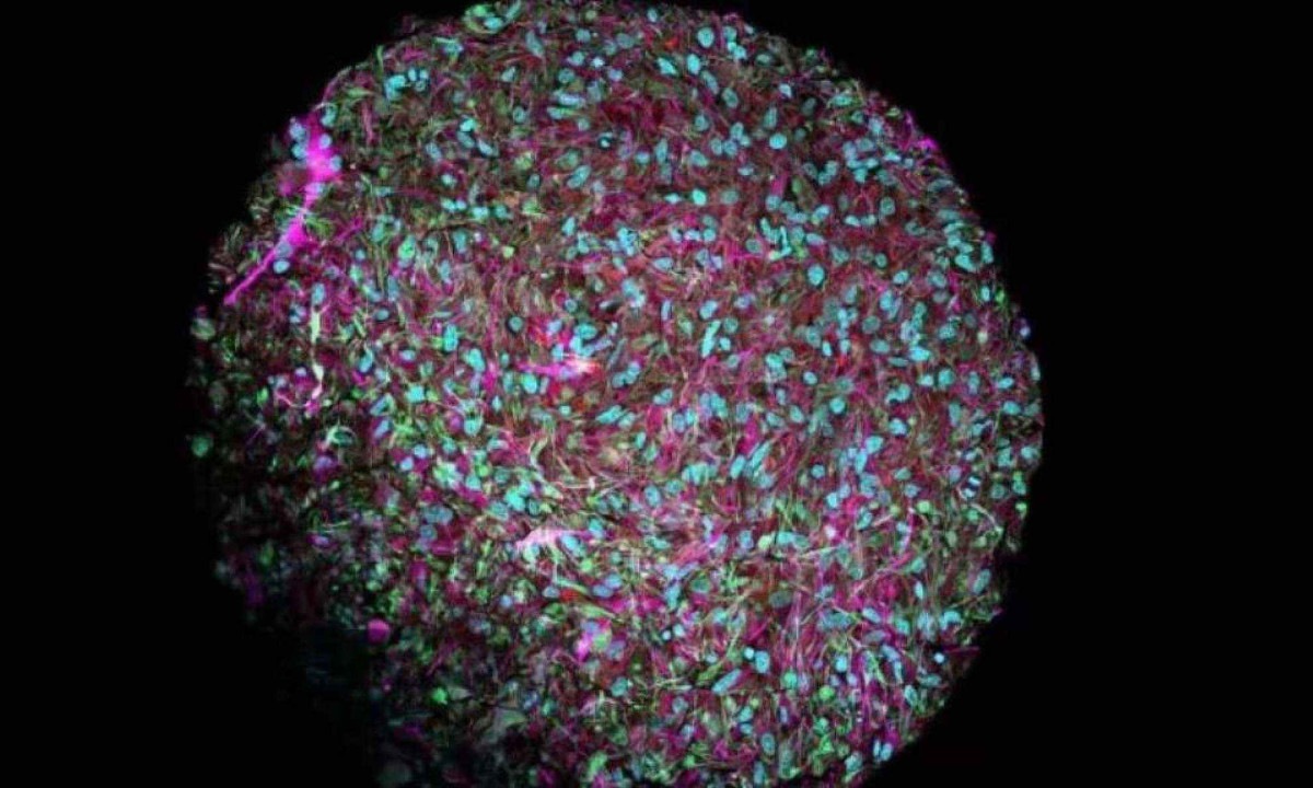 Organoide cerebral visto por um microscópio eletrônico, com os neurônios tingidos de magenta - (crédito: Jesse Plotkin/Johns Hopkins University) Organoide cerebral visto por um microscópio eletrônico, com os neurônios tingidos de magenta - (crédito: Jesse Plotkin/Johns Hopkins University)