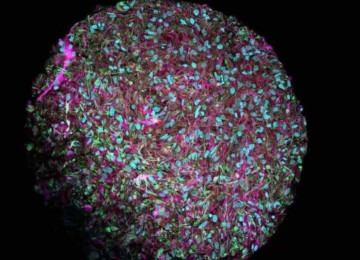 Organoide cerebral visto por um microscópio eletrônico, com os neurônios tingidos de magenta -  (crédito: Jesse Plotkin/Johns Hopkins University)