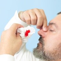 Nariz sangrando no frio: entenda o que está por trás disso - Dmitriy Sidor de Getty Images