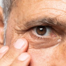 Glaucoma: a ameaça que pode roubar a visão de 2,5 milhões de brasileiros - Freepik