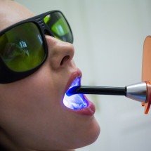 Técnicas com laser avançam em tratamentos odontológicos -  