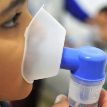 Fiocruz: 72,5% dos óbitos por SRAG estão relacionados à influenza A - Tony Winston/Agência Brasília