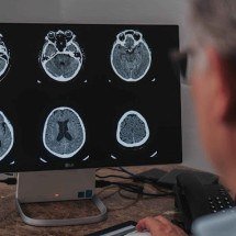 Maio Cinza: mês reforça a conscientização sobre o câncer cerebral -  Vinny Campos