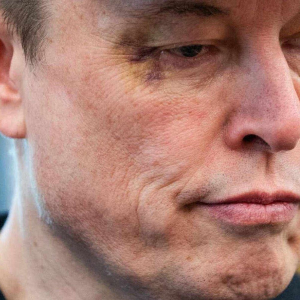 ‘clube do olho roxo’: teoria da conspiração volta com hematoma de musk