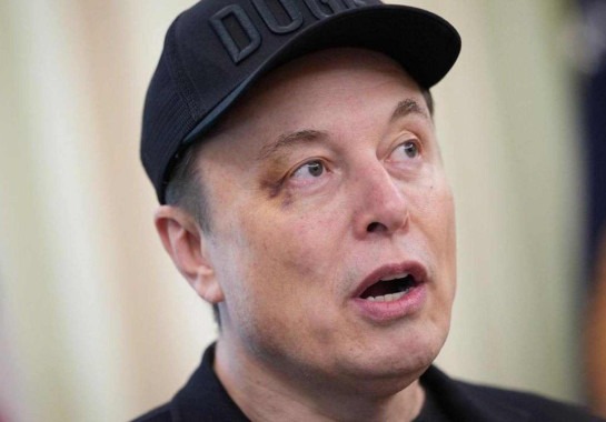 Musk explica olho roxo: 'me deu um soco na cara'