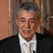 O que é a hidrocefalia de pressão normal, que motivou cirurgia em Chico Buarque - Getty Images