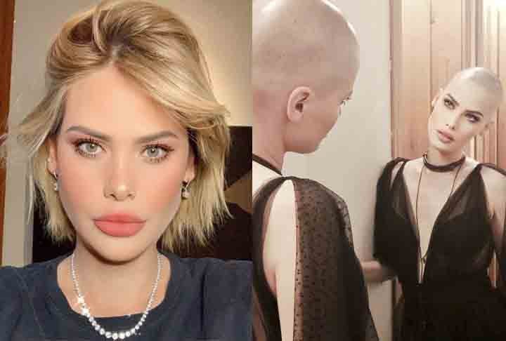   Cara Delevingne- A modelo e atriz está sempre nas páginas de fofoca, por conta da sua vida pessoal, mas em "Vida em um Ano"(2020), ela deixou as polêmicas de lado para interpretar Isabella, a namorada doente de um jovem atleta.      Mayana Moura- Para interpretar Satanás na novela  "Jesus"(2018), da TV Record, a atriz abandonou a vaidade e mergulhou no papel, que lhe rendeu boas críticas. Na época ela declarou sobre estar careca: "É maravilhoso, libertador e eu recomen