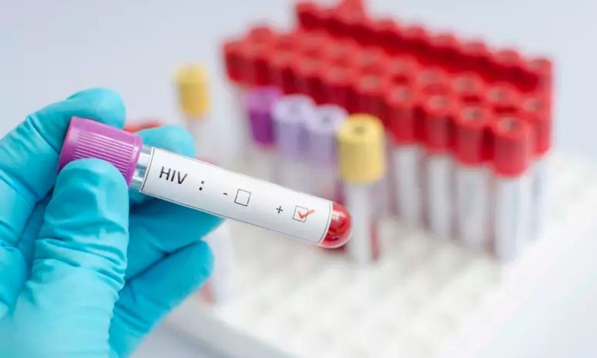 "A médica começou a conversar comigo e falou: ‘está estranho isso, vamos fazer outro teste’. E nós fizemos dois outros testes. Ambos deram negativo", conta o estudante  -  (crédito: Reprodução /iStock)