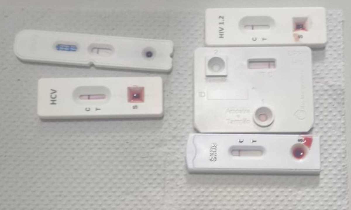 Na quarta-feira (4/6), o estudante realizou novamente os testes, que constaram negativo para HIV e outras ISTs Na quarta-feira (4/6), o estudante realizou novamente os testes, que constaram negativo para HIV e outras ISTs