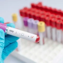 Estudante é surpreendido com resultado de falso positivo para HIV em Minas - Reprodução /iStock