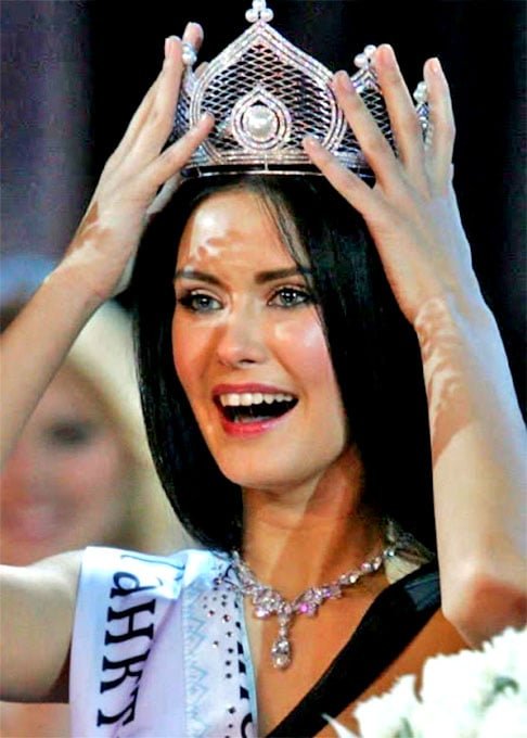 Sofia Rudieva (2009) - A Miss RÃºssia balanÃ§ou no cargo quando fotos erÃ³ticas dela vazaram na imprensa. Mas, ainda assim, ela pÃŽde participar do Miss Universo.  
