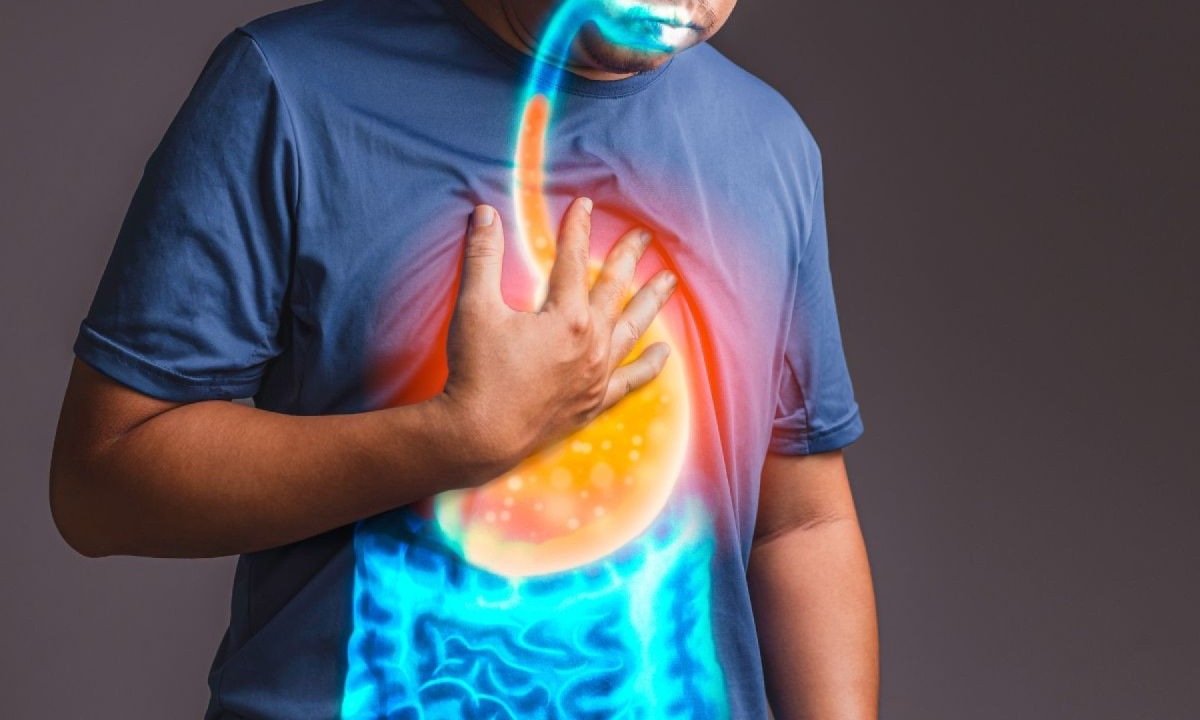 Refluxo ácido pode se manifestar com tosse seca e queimação no peito  -  (crédito: undefined undefined de Getty Images)