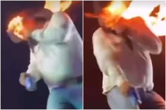Cantor tem rosto atingido por fogo durante show