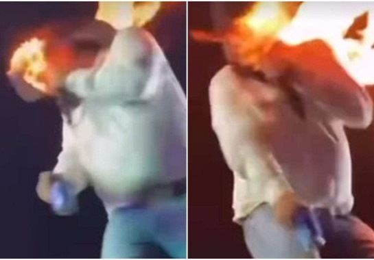 Cantor tem rosto atingido por fogo durante show