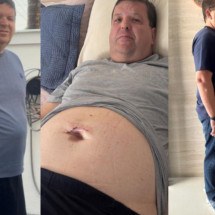 Entre a insegurança e o medo: a saga de quem viveu com hérnias por 45 anos - Arquivo pessoal