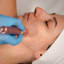 Rejuvenescimento facial movimenta setor estético no Brasil - DINO