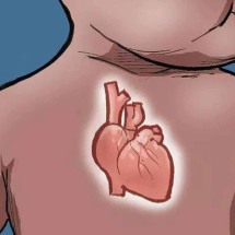 O caso do bebê com cardiopatia congênita que sobreviveu a um cateterismo