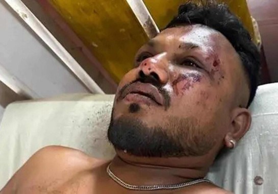 Há pelo menos um sobrevivente do avião que caiu na Índia