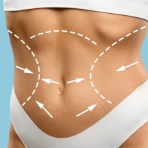  Young woman in underwear with perfect skin, slim figure, collage
     -  (crédito: DINO)