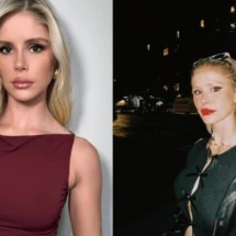 Atriz de "The Boys" revela diagnóstico de doença de graves; veja sintomas  - Redes Sociais/Reprodução