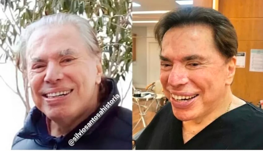 Em 2021, quando a pandemia começou a ceder, Silvio deu mostras de que poderia voltar ao palco. Ele tingiu os cabelos brancos - visual que o público quase não vê. O cabeleireiro Jassa postou e muitos acharam que Silvio voltaria imediatamente. Mas ele ficou em casa.