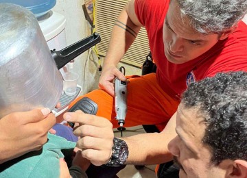 Com panela de pressão presa na cabeça, menino é socorrido por bombeiros -  (crédito: CBMG/DivulgaÃ§Ã£o)