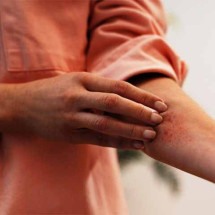 Identificar e controlar alergias pode melhorar qualidade de vida -  Imagem Freepik