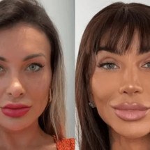 Andressa Urach muda cor dos olhos com cirurgia proibida no Brasil; entenda - Redes Sociais/Reprodução